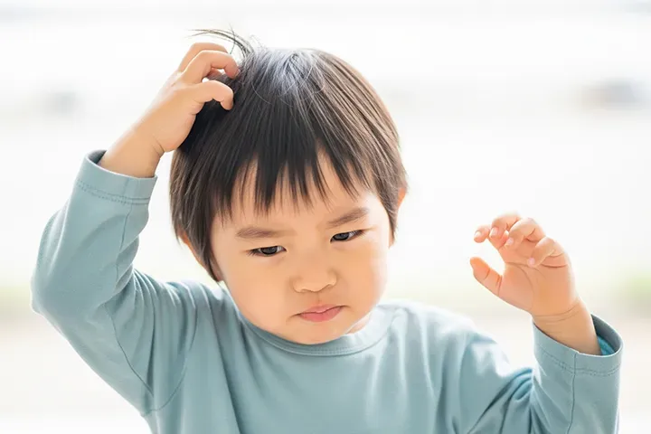 子どもが頭をかゆがる原因は？フケ・乾燥・汗など頭皮トラブルのケアと受診目安を小児科医が解説