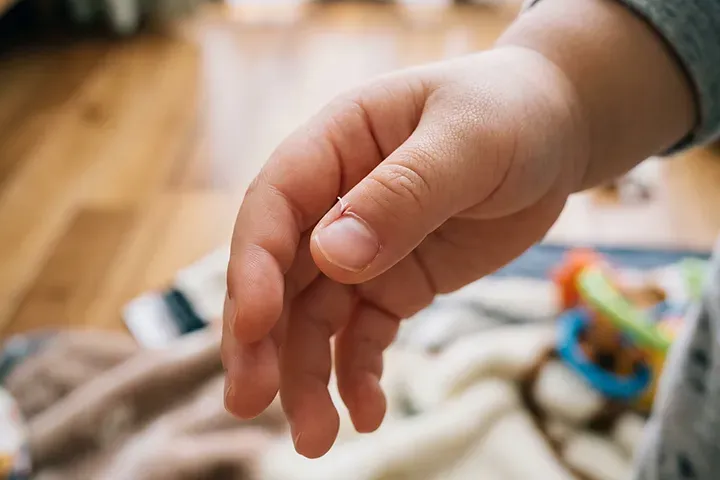 子どものささくれ・さかむけの原因と対処法｜痛み・化膿時のケアと予防を解説