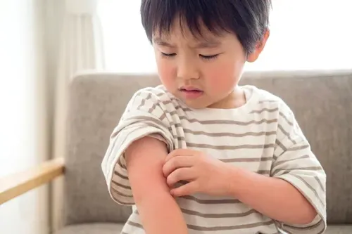 子どもの日焼けでかゆみ・赤みが出たら？正しいスキンケアと受診目安