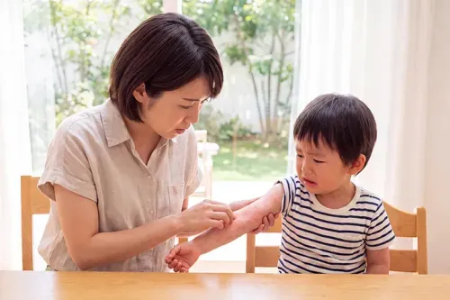 子どもの食物アレルギーはいつおさまる？持続時間とアナフィラキシーの見分け方を解説
